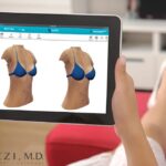 Image of women looking for the prefect breast implant using Crisalix 3D software