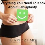 Women in black shorts holding green smiley face with text "Everything You Need To Know About Labiaplasty" and Capizzi MD logo
