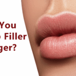 Close up of woman's lips after a Lip Filler procedure with the words "How do you make lip filler last longer?