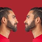 Before and After Comparison of a Man with an Ultrasonic Rhinoplasty