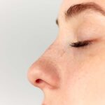 Woman's nose after a Septoplasty. Septoplasty vs. Rhinoplasty