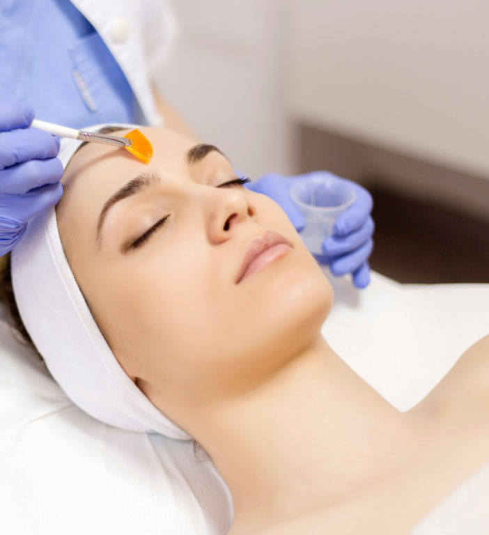 Chemical Peels