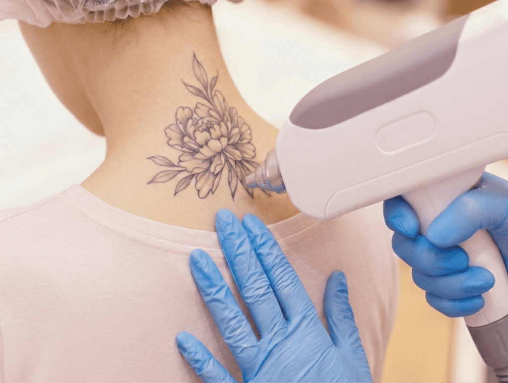 Breast Augmentation Gallery