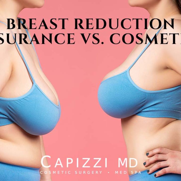 Woman facing herself showing the difference between an Insurance Vs. Cosmetic Breast Reduction.