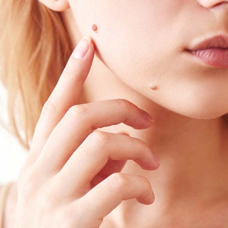 Dermatologist vs. Plastic Surgeon. Which is Better?