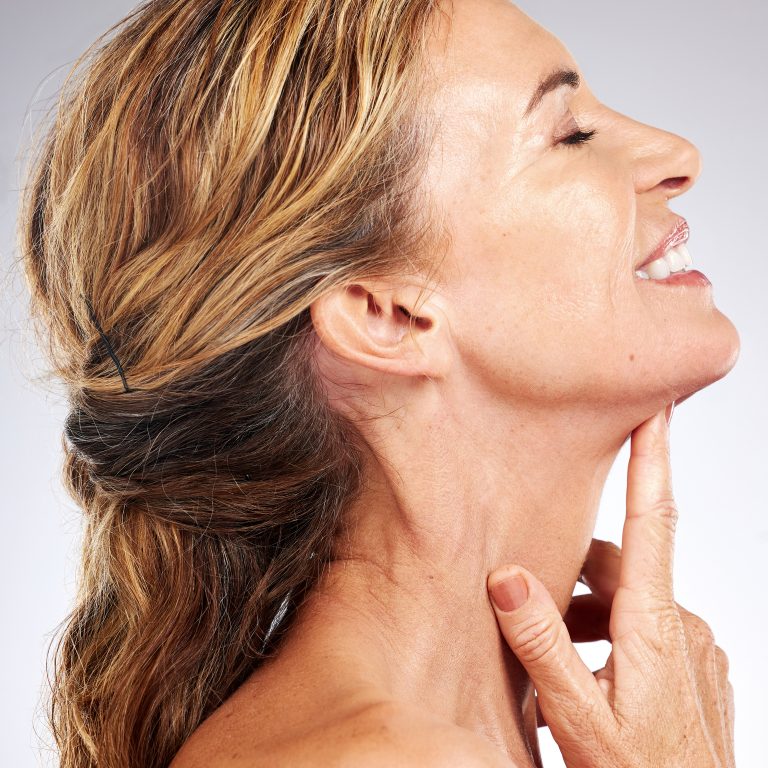 Neck Lift